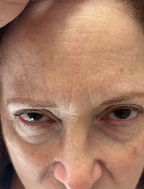 Facial Trauma case #18570