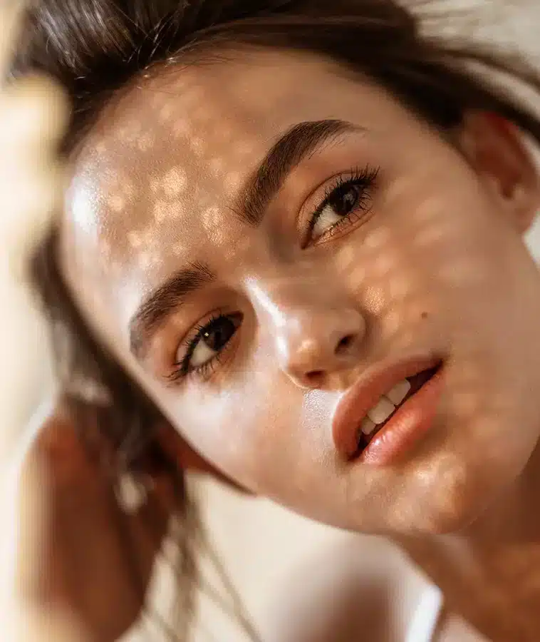 1765310635_microneedling-what