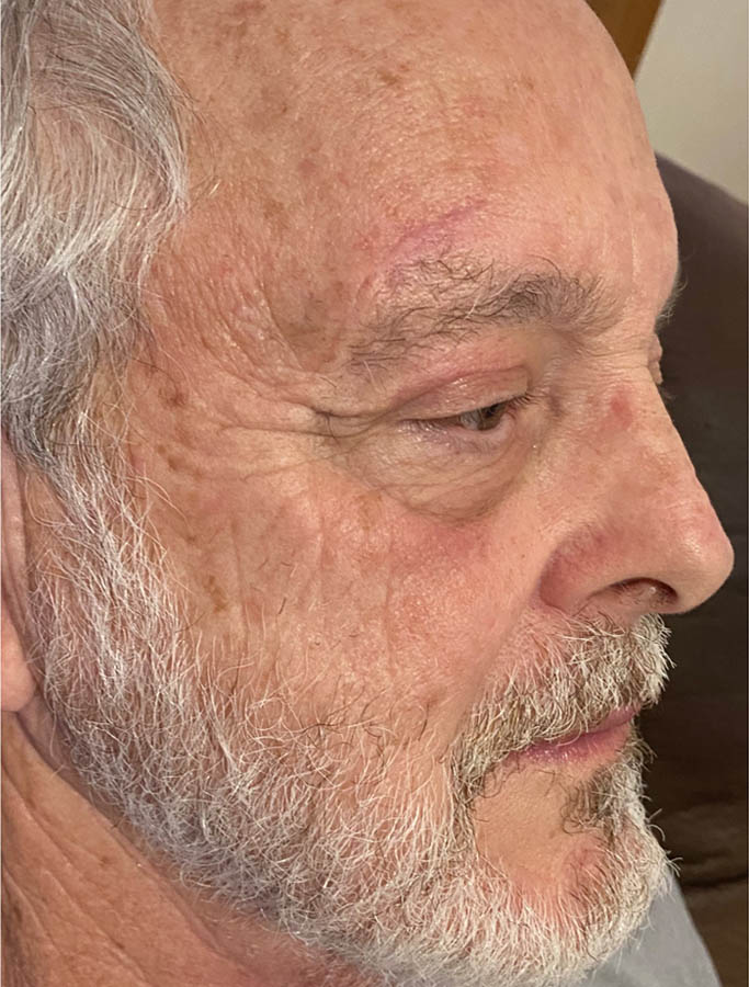 After Image: Patient Case #17834 - right-front-oblique