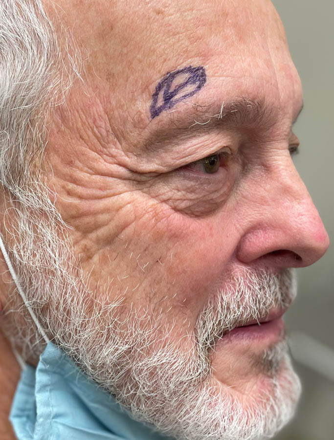 Before Image: Patient Case #17834 - right-front-oblique