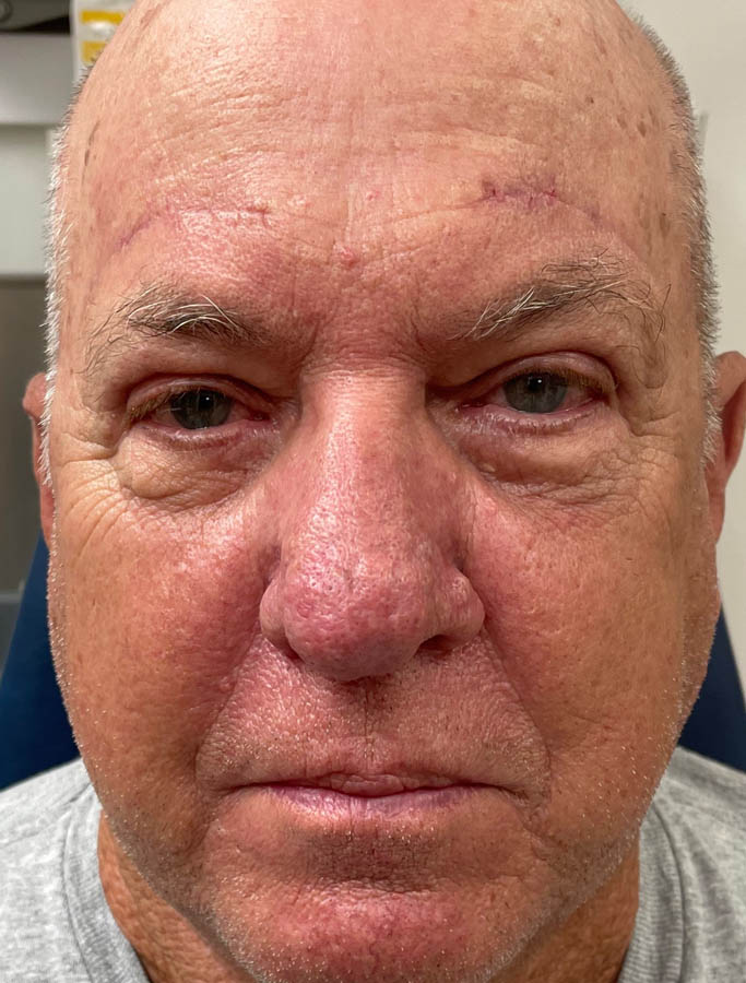 After Image: Patient Case #17866 - front