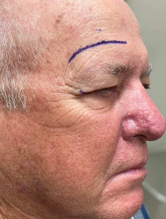 Before Image: Patient Case #17866 - right-front-oblique