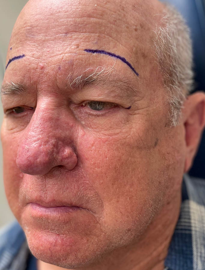 Before Image: Patient Case #17866 - left-front-oblique