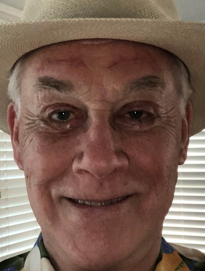 After Image: Patient Case #17877 - front