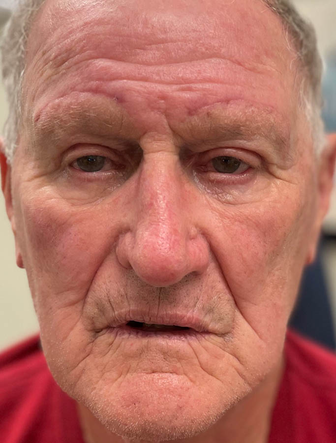 After Image: Patient Case #17880 - front