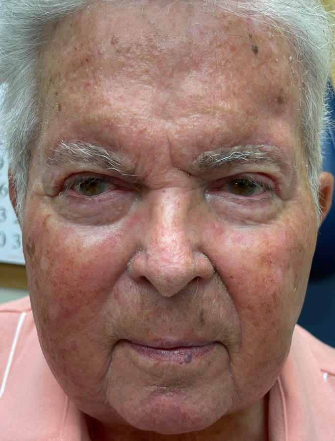 After Image: Patient Case #17883 - front