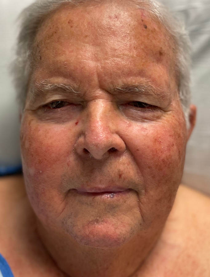 Before Image: Patient Case #17883 - front