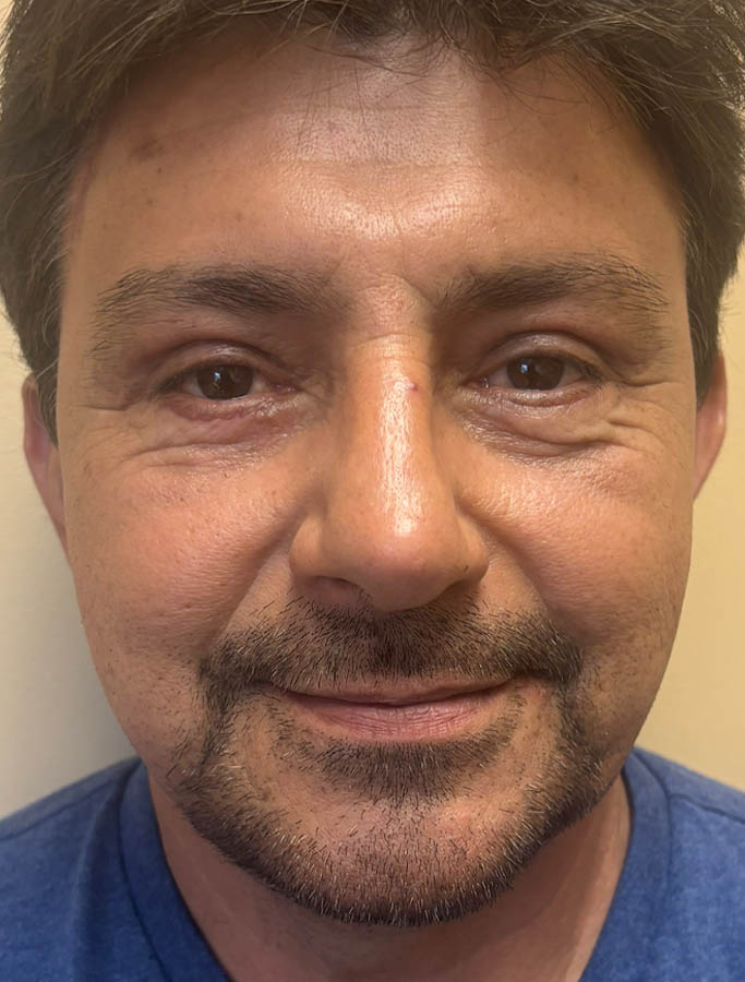 After Image: Patient Case #18625 - front