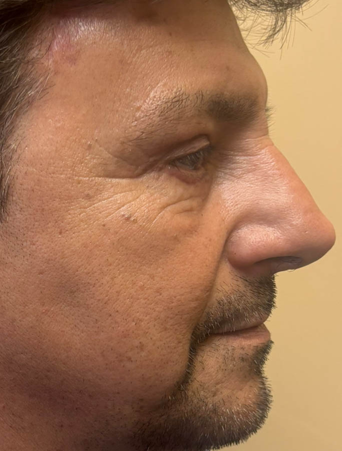 After Image: Patient Case #18625 - right-side