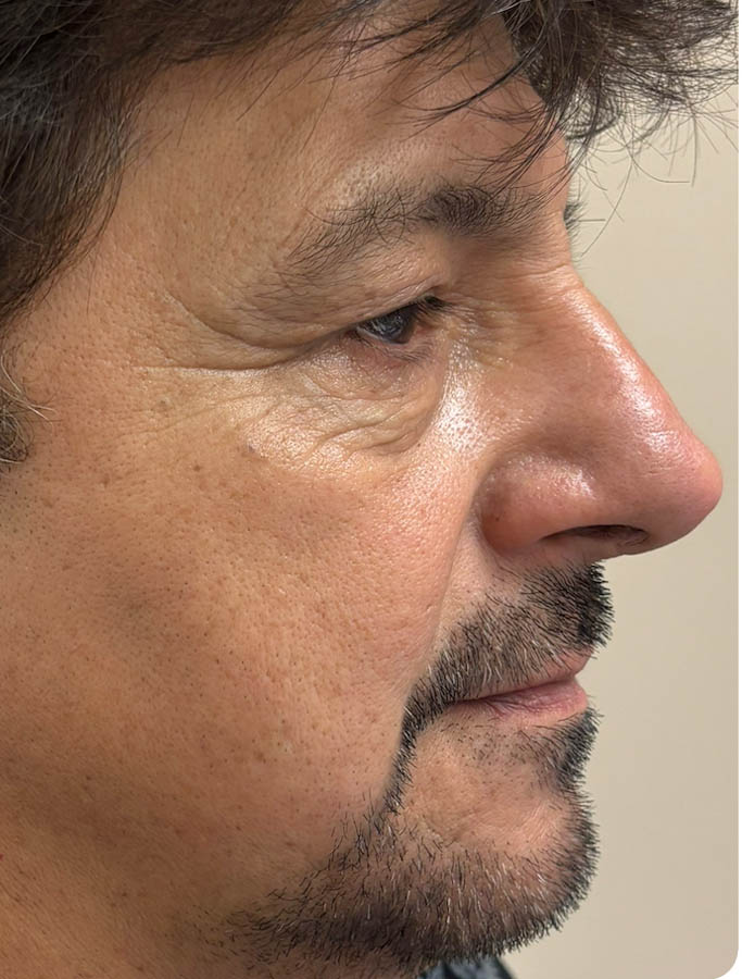 Before Image: Patient Case #18625 - right-side