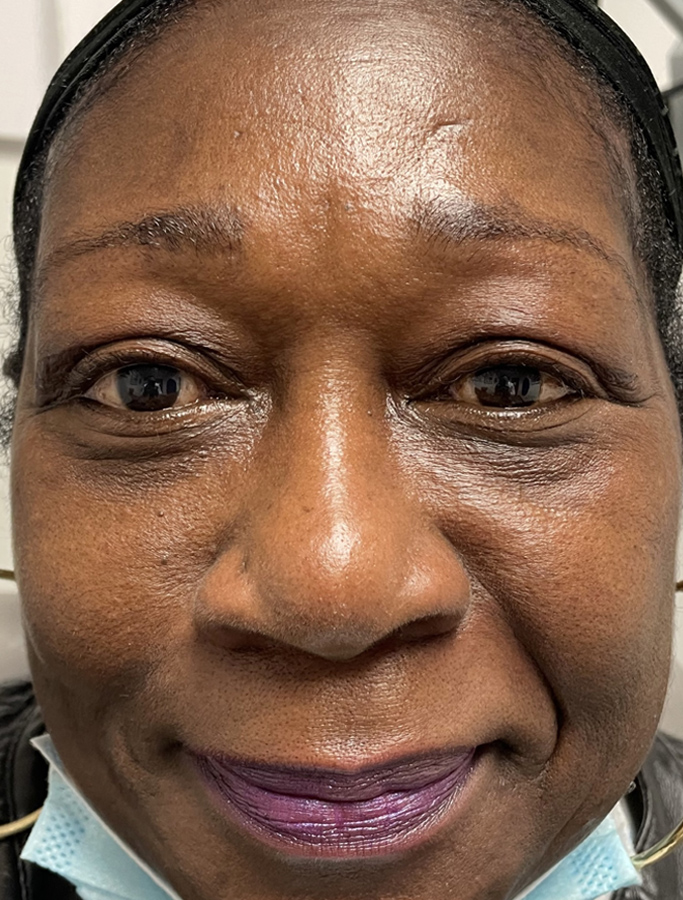 After Image: Patient Case #1868 - front