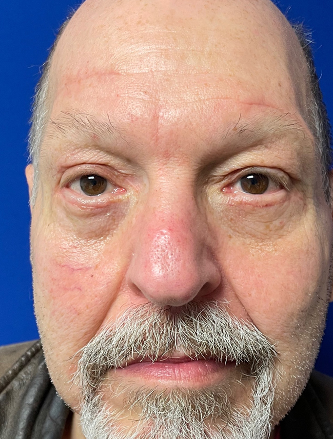 After Image: Patient Case #1894 - front