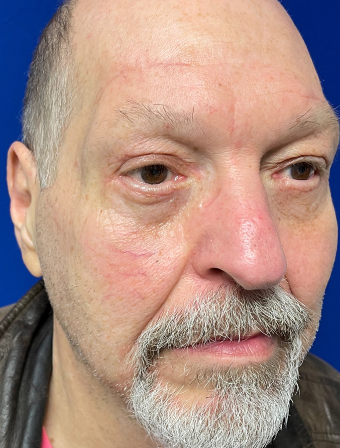 After Image: Patient Case #1894 - right-front-oblique