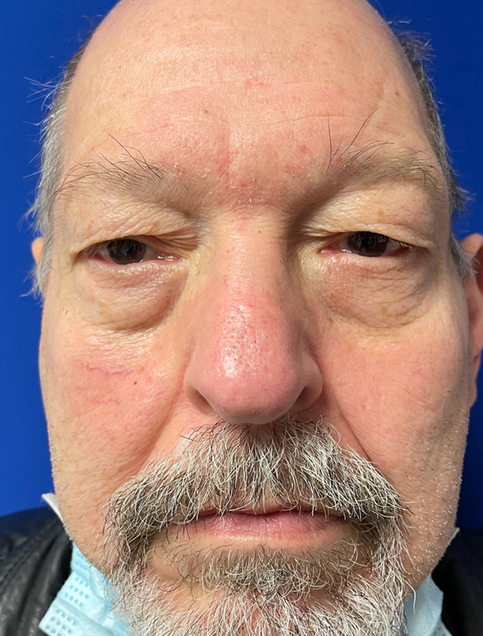 Before Image: Patient Case #1894 - front