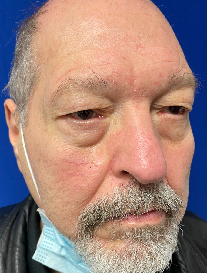 Before Image: Patient Case #1894 - right-front-oblique