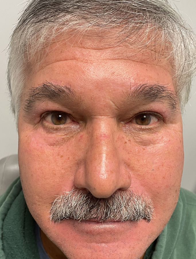 After Image: Patient Case #1904 - front