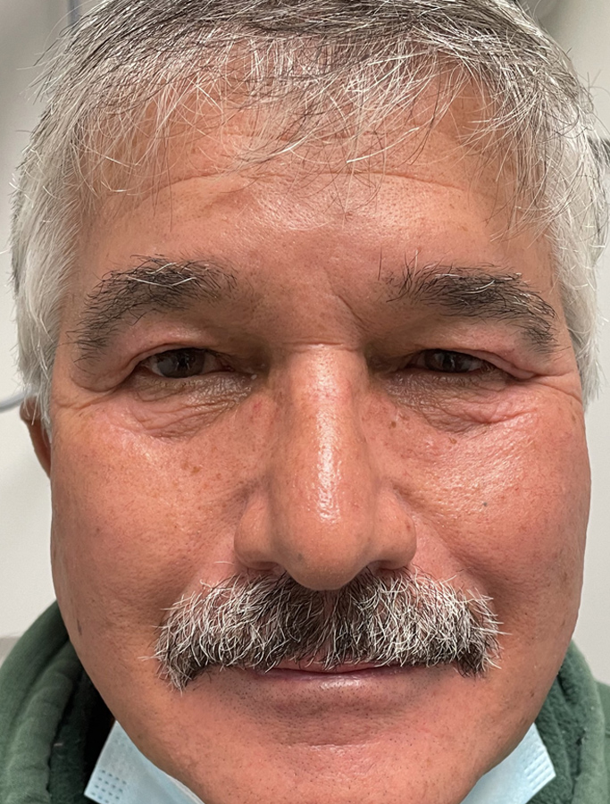 Before Image: Patient Case #1904 - front