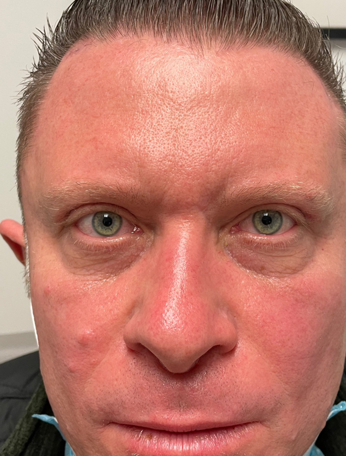 After Image: Patient Case #1919 - front