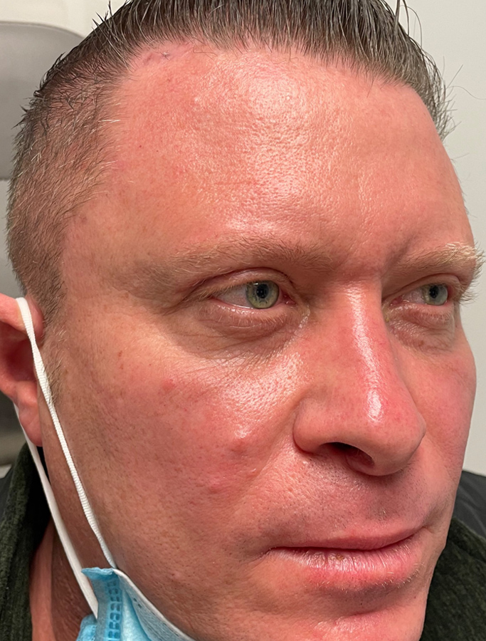 After Image: Patient Case #1919 - right-front-oblique