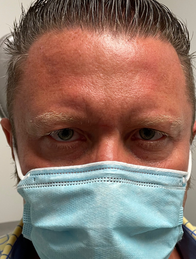 Before Image: Patient Case #1919 - front