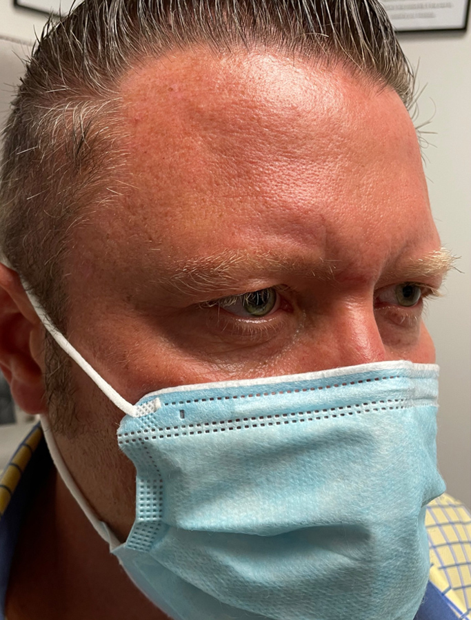 Before Image: Patient Case #1919 - right-front-oblique