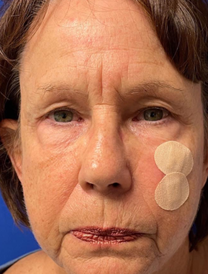 Before Image: Patient Case #1949 - front