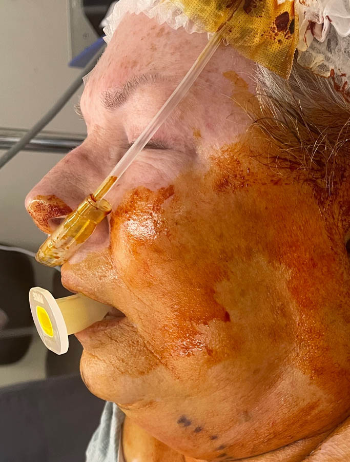 Before Image: Patient Case #18086 - left-side