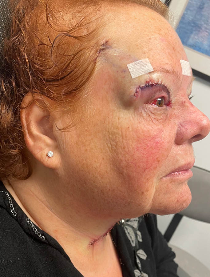 After Image: Patient Case #18104 - right-side