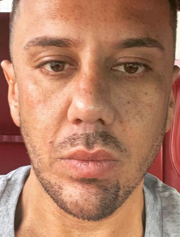 After Image: Patient Case #18112 - front