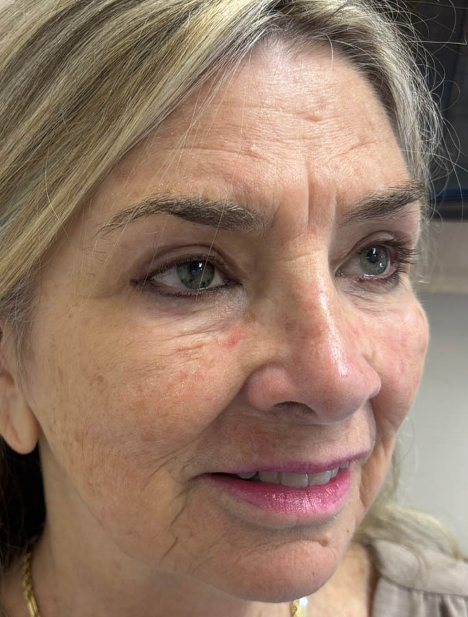 Before Image: Patient Case #18907 - right-front-oblique