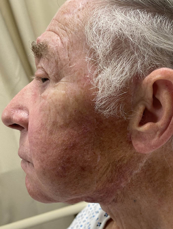 Before Image: Patient Case #18109 - left-side