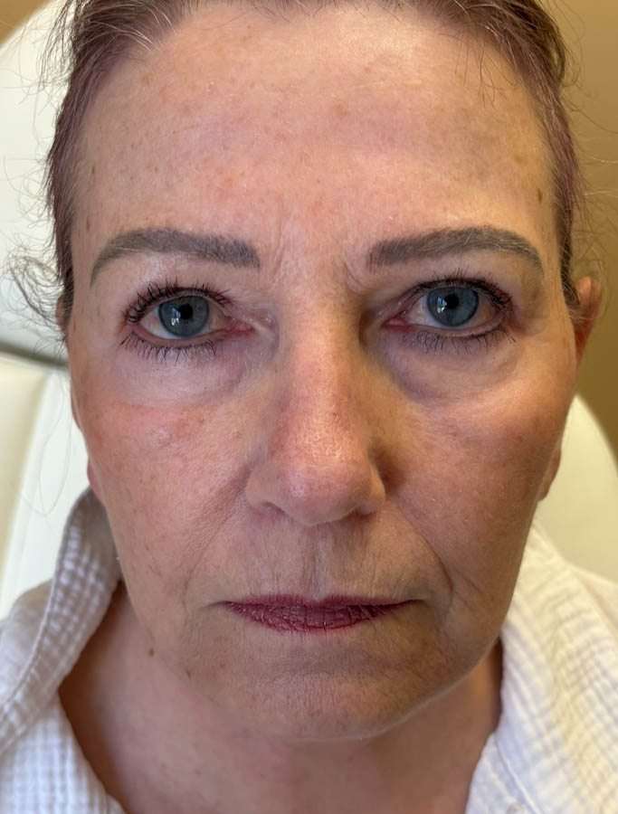 After Image: Patient Case #18636 - front