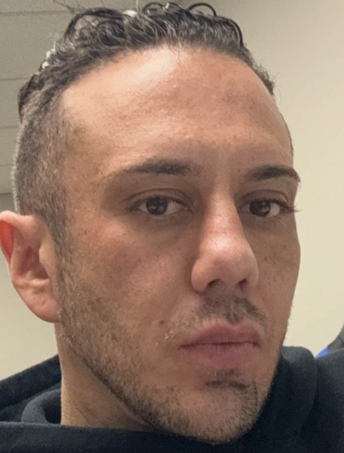 After Image: Patient Case #18904 - right-front-oblique