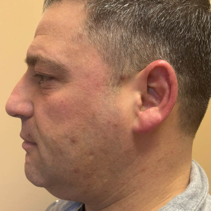 Before Image: Patient Case #18559 - left-side