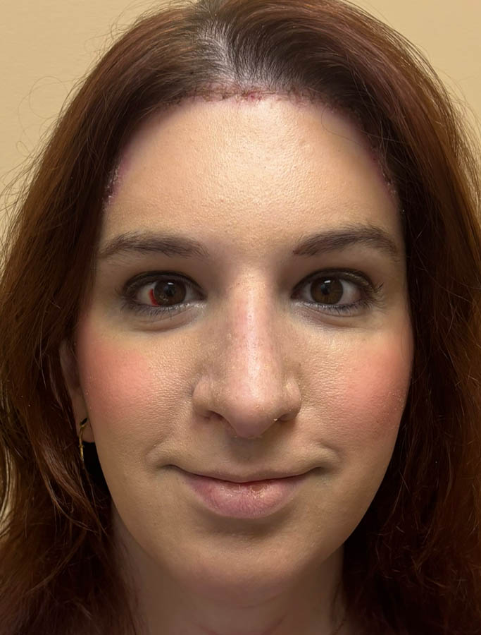 After Image: Patient Case #18917 - front