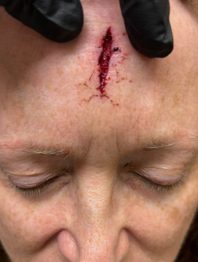 Before Image: Patient Case #18570 - front