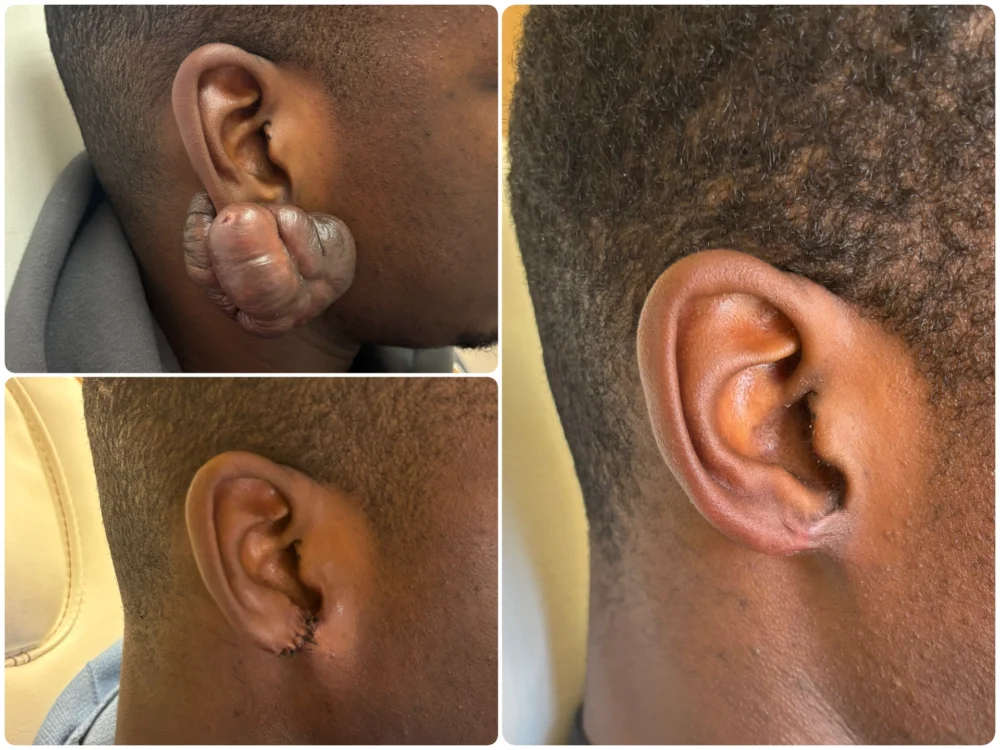 Before Image: Patient Case #18593 - right-side