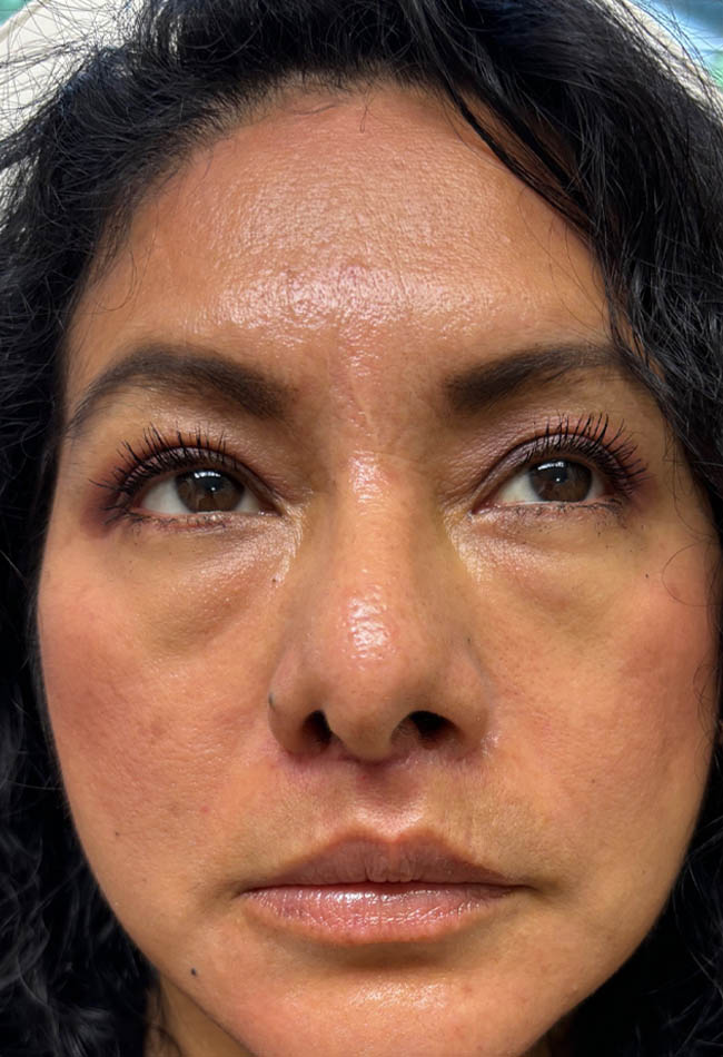 After Image: Patient Case #17818 - front