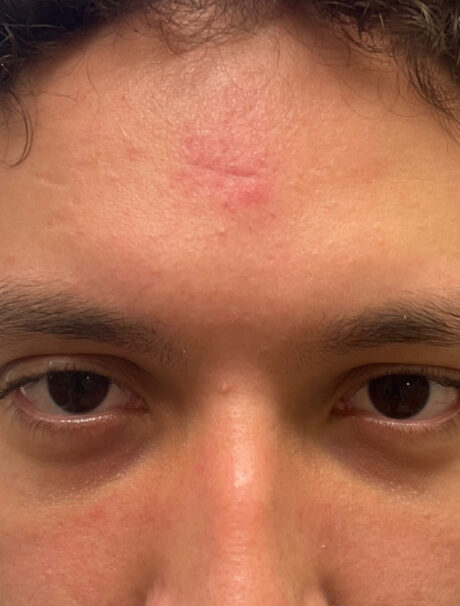 After Image: Patient Case #1634 - front