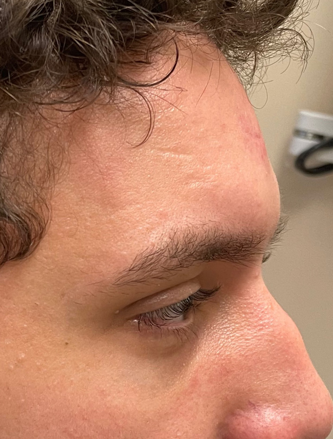 After Image: Patient Case #1634 - right-side