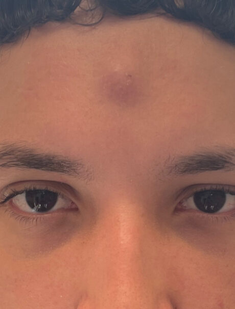 Before Image: Patient Case #1634 - front