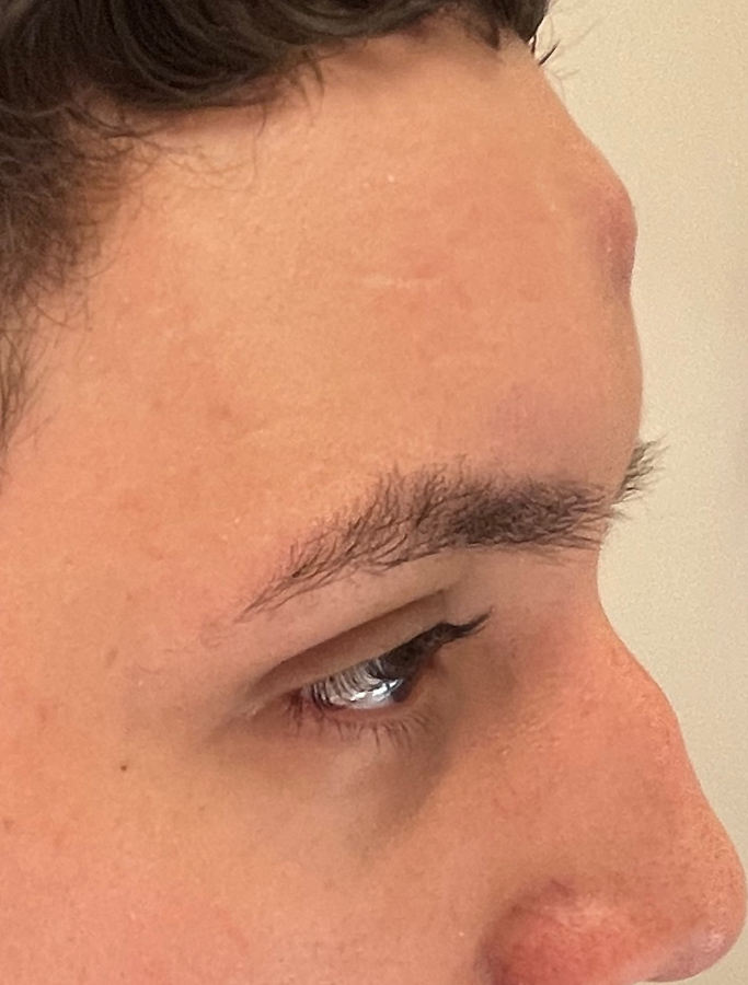 Before Image: Patient Case #1634 - right-side