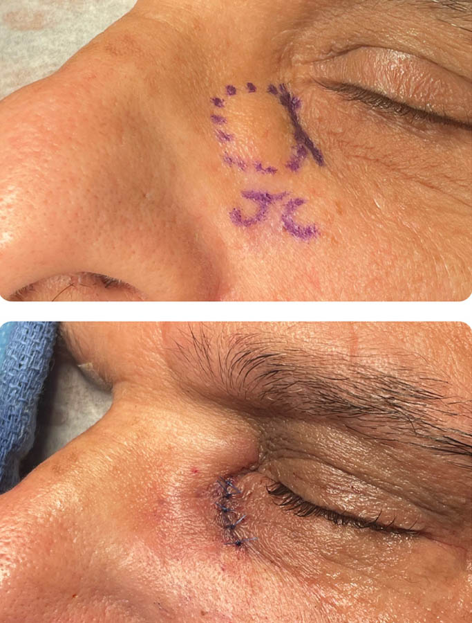 Before Image: Patient Case #17909 - left-front-oblique