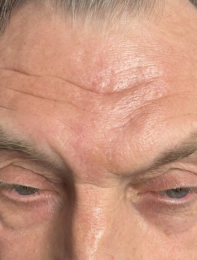 After Image: Patient Case #17921 - front