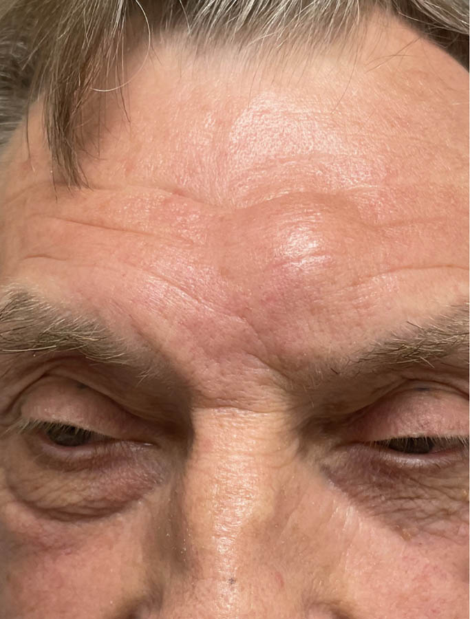 Before Image: Patient Case #17921 - front