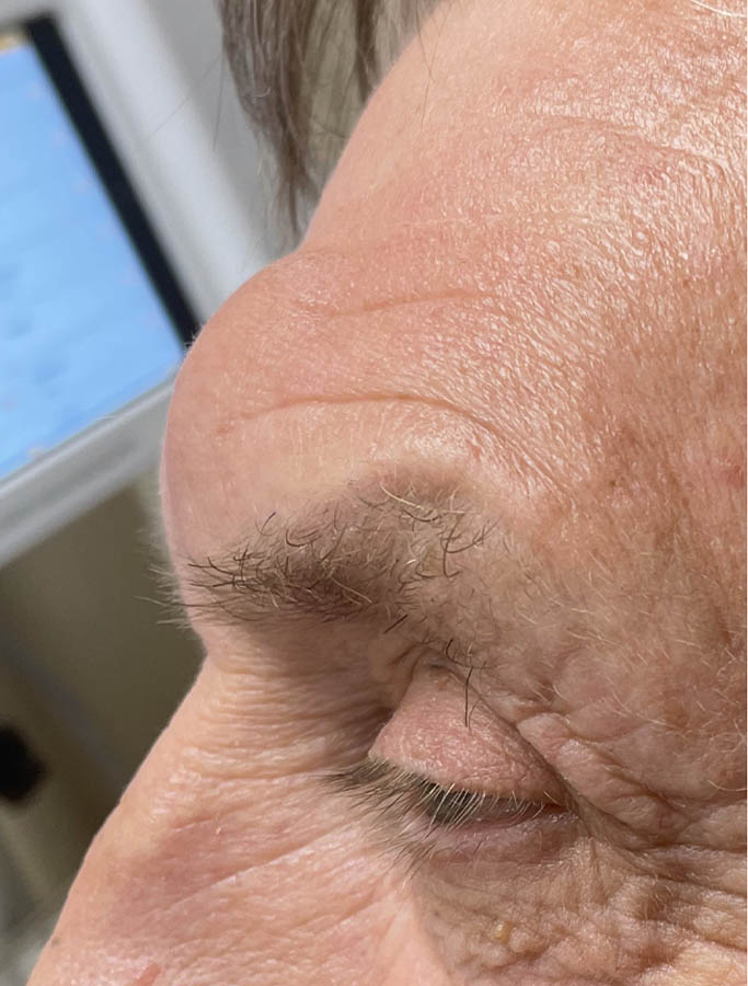 Before Image: Patient Case #17921 - left-side