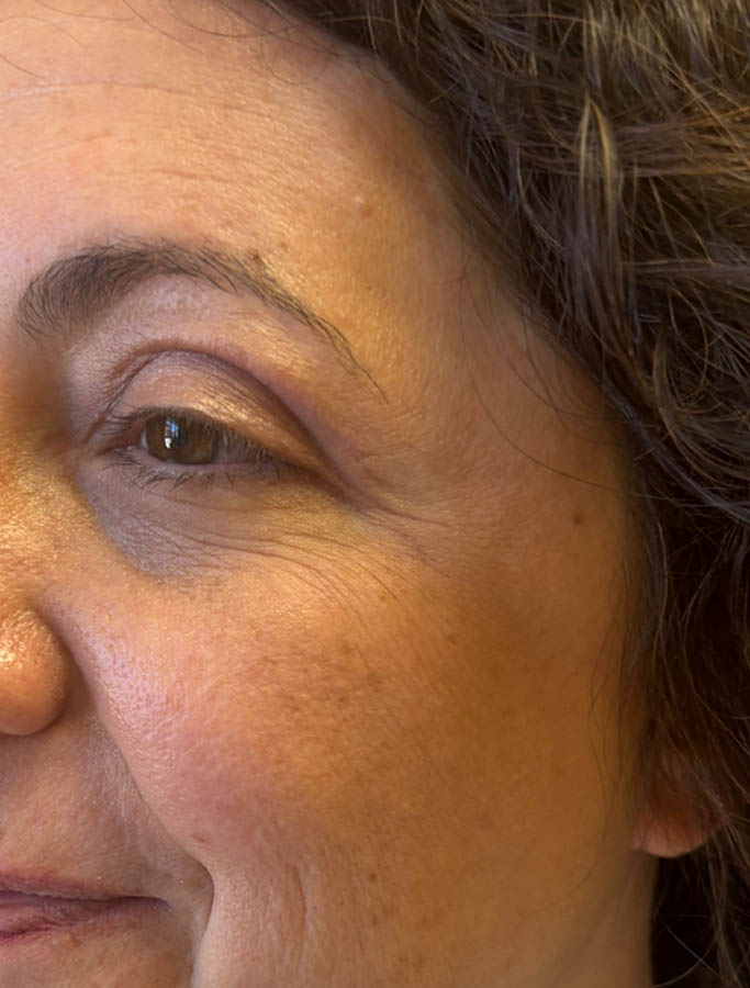 After Image: Patient Case #18573 - left-front-oblique