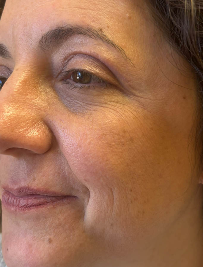 After Image: Patient Case #18573 - left-front-oblique