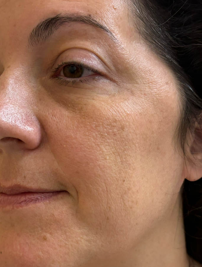 Before Image: Patient Case #18573 - left-front-oblique