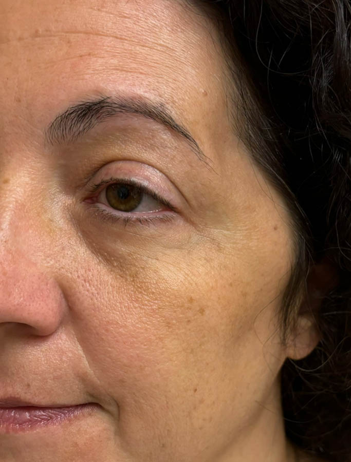 Before Image: Patient Case #18573 - left-front-oblique